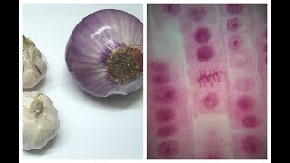 Mitosis in Onion Root tip Experiment [upl. by Jezabel771]