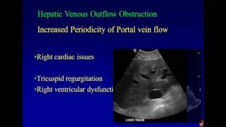 Ultrasound Imaging of Portal Hypertension [upl. by Akital871]