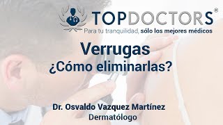 ¿Cómo eliminar las verrugas  Tratamientos [upl. by Daffy]