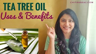 TEA TREE OIL  How to use tea tree oil for Acne Hair Growth and other benefits  Melaleuca Oil [upl. by Uttasta]