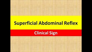 Superficial Abdominal Reflex  Clinical Sign  Neurology [upl. by Enoob]