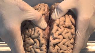 Introduction Neuroanatomy Video Lab  Brain Dissections [upl. by Rednazxela]