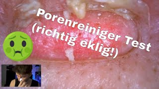 Mitesser Sauger  Entferner  Porenreiniger Test als MANN  Richtig Satisfying To Watch [upl. by Aioj]