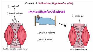 Orthostatic Hypotension Described Concisely [upl. by Torry]