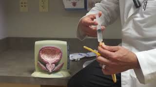 How a Bladder Catheter Works [upl. by Greenleaf]