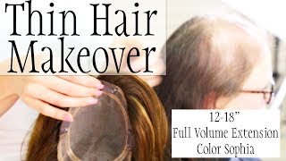 Fine Thin Hair Replacement topper hairpiece makeover alopecia [upl. by Dnilasor460]